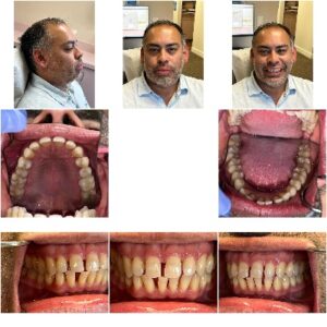 Collage showing patient portraits and detailed dental views at Smile Gallery at Westlake Village Dental