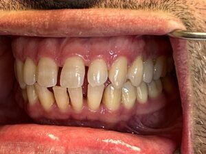 Close-up of upper and lower teeth showing natural alignment and gums at Smile Gallery at Westlake Village Dental