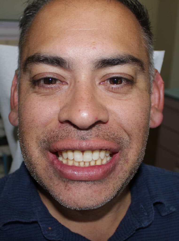 Man smiling broadly showing teeth and facial expression at Smile Gallery at Westlake Village Dental