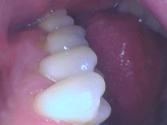 Side view of upper and lower teeth showing healthy alignment at Smile Gallery at Westlake Village Dental
